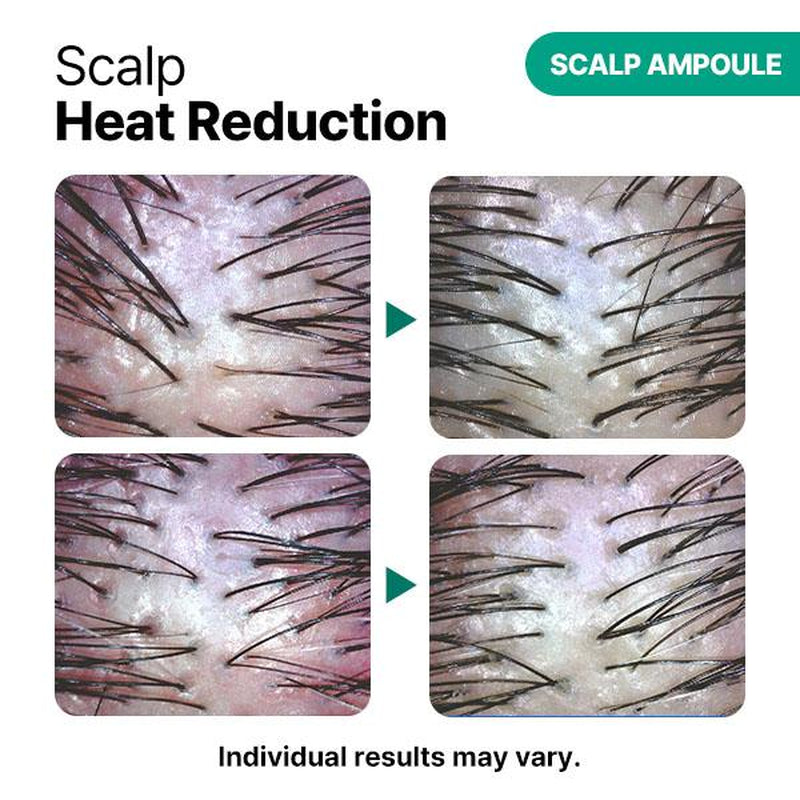 FRANZ SKINCARE Meli-Care Hair Duo Set - Treatment & Scalp Ampoule for 120-Hour Protein Repair & Anti-Hair Loss Solution