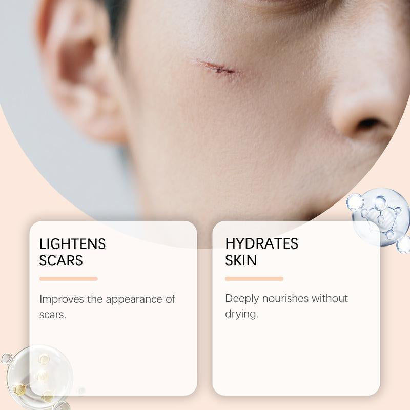 Scar Solutions Silicone Scar Stick for Face and Body 60% Soothing Moisturizing Gentle on All Skin Types Easy-To-Use Stick Design 6G