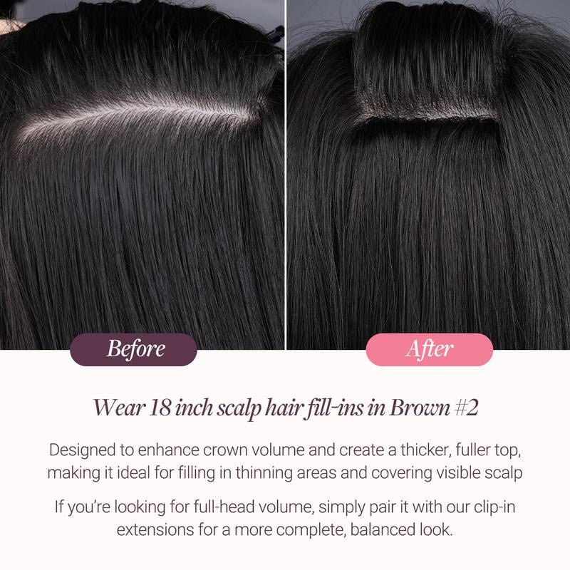 GOO GOO Scalp Hair Fill-Ins Clip-In Short Hair Extensions Real Human Hair, Thinning Hair Fill-Ins Natural Look Volumizer for Women