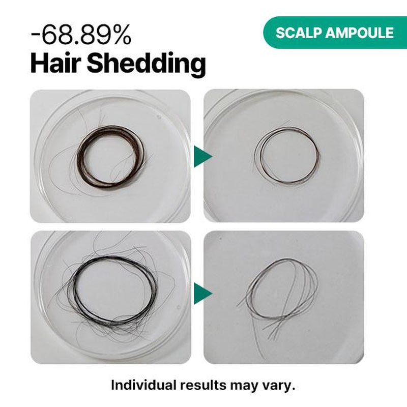 FRANZ SKINCARE Meli-Care Hair Duo Set - Treatment & Scalp Ampoule for 120-Hour Protein Repair & Anti-Hair Loss Solution