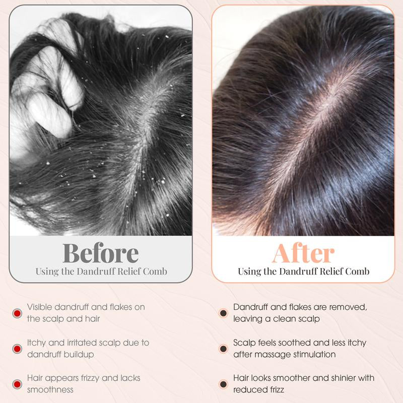 Scalp Sweep Dandruff Removal Massage Comb for Greasy Scalp Promotes Blood Circulations Removes Oil Dandruff Enhances Hair Shine